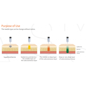HYALMASS Hyper Cross-linked Hyaluronic acid filler - 1syr*1,0 ml S. Korea